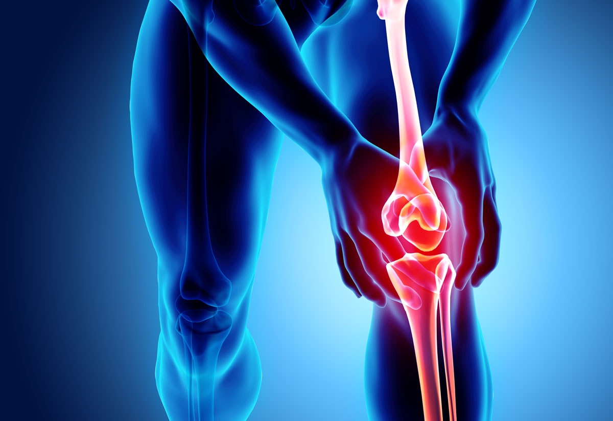 Darstellung eines Schmerzpunktes im Knie